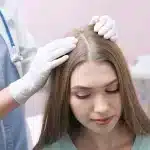 Transplant de păr pentru femei