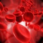 Anemia Treatment