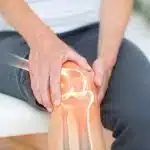 Behandlung von Knien