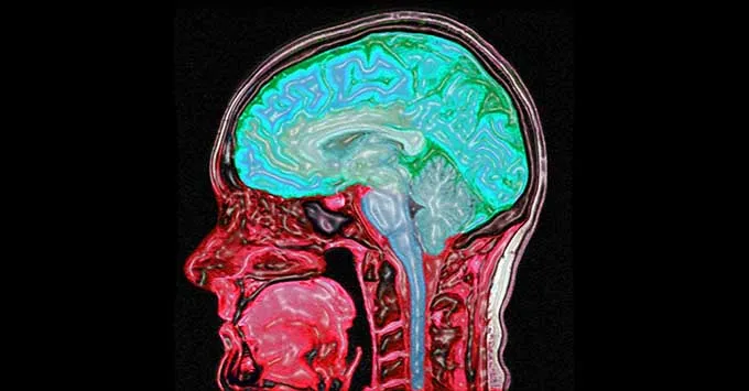 Nutrition, Exercise and Lifestyle Changes in Neurodegenerative Diseases: A Holistic Perspective